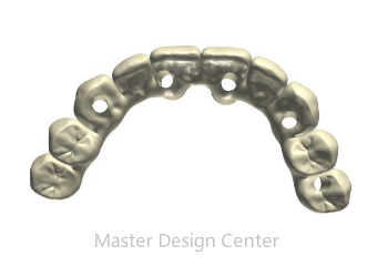 Screw Retained