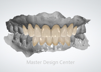 Diagnostic Wax Up