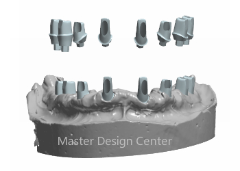 Abutment Design