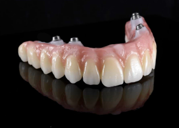 Implant Hybrid Bridge Milling